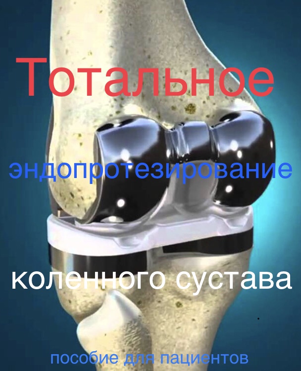 Травмотология и ортопедия. Протезирование коленного сустава